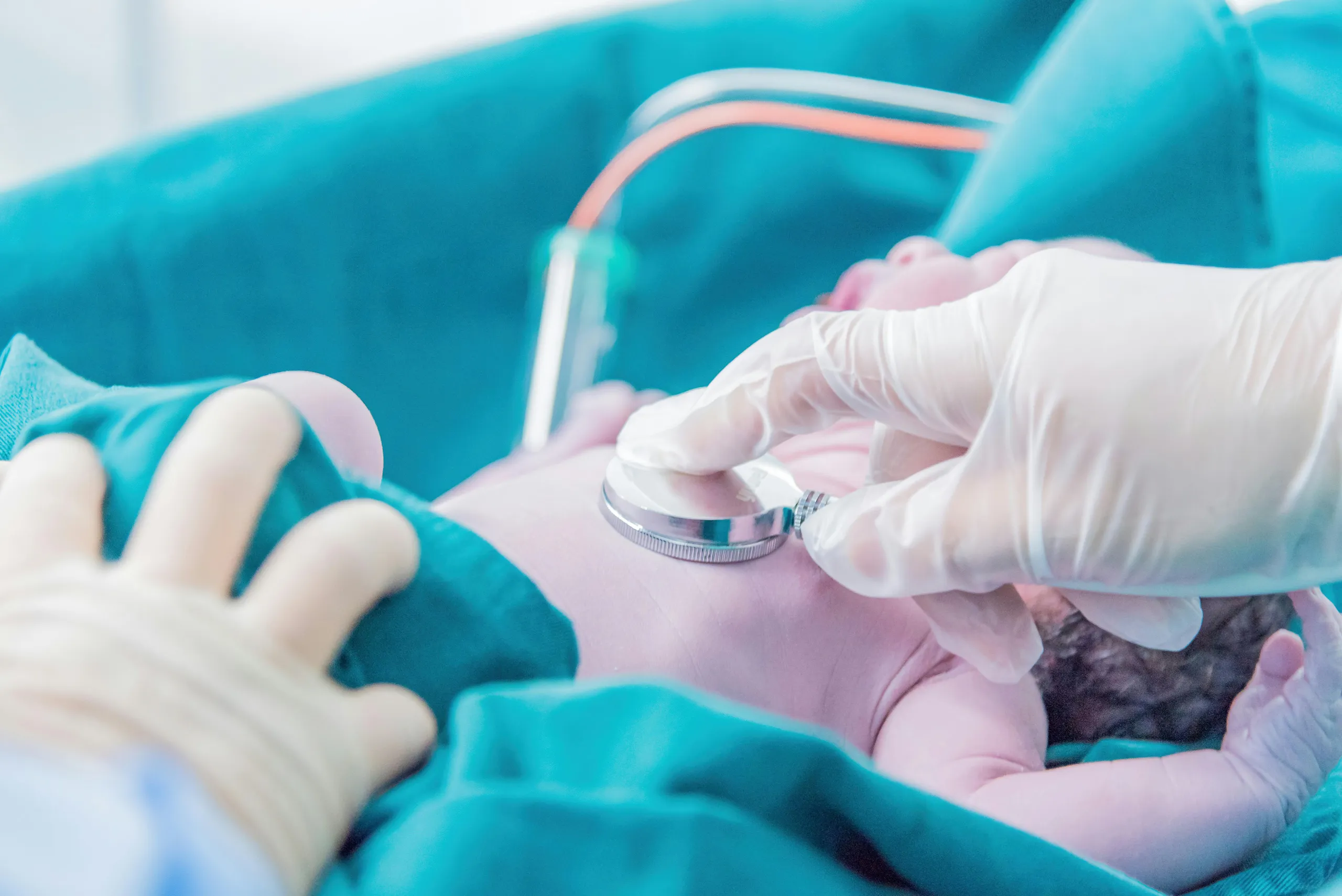 A healthcare professional uses a stethoscope to examine a newborn baby lying on a hospital bed.